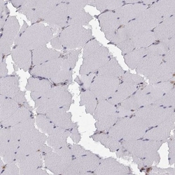 Plakophilin 1 Antibody, Novus Biologicals:Antibodies:Primary Antibodies