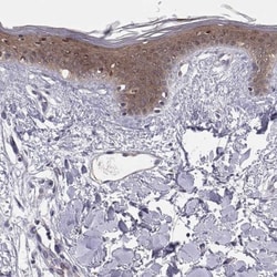 Plakophilin 1 Antibody, Novus Biologicals:Antibodies:Primary Antibodies