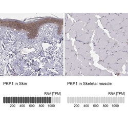 Plakophilin 1 Antibody, Novus Biologicals:Antibodies:Primary Antibodies
