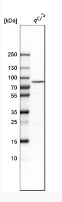 Plakophilin 1 Antibody, Novus Biologicals:Antibodies:Primary Antibodies