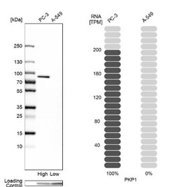 Plakophilin 1 Antibody, Novus Biologicals:Antibodies:Primary Antibodies