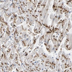 Plakophilin 2 Antibody, Novus Biologicals 25 &mu;L | Buy Online | Novus Biologicals | Fisher Scientific