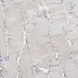 Plakophilin 2 Antibody, Novus Biologicals 25 &mu;L | Buy Online | Novus Biologicals | Fisher Scientific