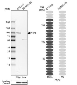 Plakophilin 2 Antibody, Novus Biologicals 25 &mu;L | Buy Online | Novus Biologicals | Fisher Scientific