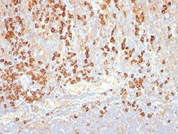 Mouse anti-Plasma Cell, Clone: LIV3G11 (7B18), Novus Biologicals 0.2 mg | Buy Online | Novus Biologicals | Fisher Scientific