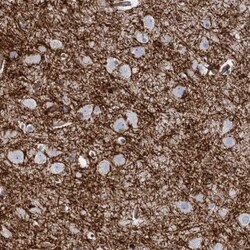 Plasmolipin Antibody, Novus Biologicals 0.1mL; Unlabeled:Antibodies, Polyclonal