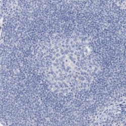 Plasmolipin Antibody, Novus Biologicals 0.1mL; Unlabeled:Antibodies, Polyclonal