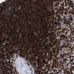 Plastin L Antibody, Novus Biologicals 0.1mL; Unlabeled:Antibodies, Polyclonal