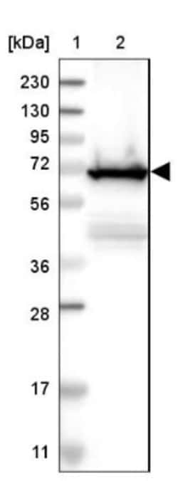 Plastin L Antibody, Novus Biologicals 0.1mL; Unlabeled:Antibodies, Polyclonal