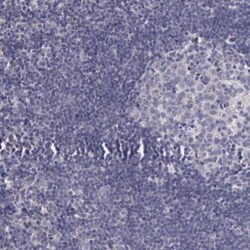 Pleckstrin-2 Antibody, Novus Biologicals 0.1mL; Unlabeled:Antibodies, Polyclonal