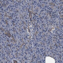 Plectin Antibody, Novus Biologicals 0.1mL; Unlabeled:Antibodies, Polyclonal
