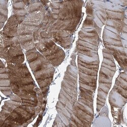 Plectin Antibody, Novus Biologicals 0.1mL; Unlabeled:Antibodies, Polyclonal