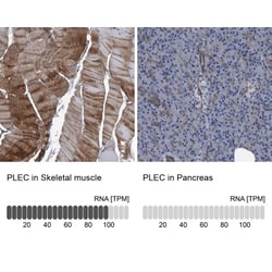 Plectin Antibody, Novus Biologicals 0.1mL; Unlabeled:Antibodies, Polyclonal
