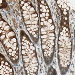 Plexin A1 Antibody, Novus Biologicals 0.1mL; Unlabeled:Antibodies, Polyclonal