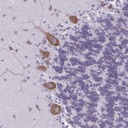 Plexin B3 Antibody, Novus Biologicals 25 &mu;L, Unlabeled:Antibodies, Polyclonal