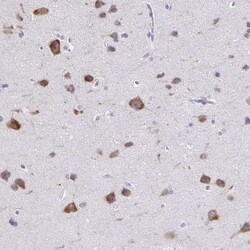 Plexin B3 Antibody, Novus Biologicals 25 &mu;L, Unlabeled:Antibodies, Polyclonal