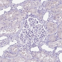 Plexin B3 Antibody, Novus Biologicals 25 &mu;L, Unlabeled:Antibodies, Polyclonal