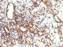 Podocalyxin Like Antibody (2A4), Novus Biologicals 0.2mg; Unlabeled:Antibodies,