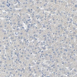 Podoplanin Antibody, Novus Biologicals:Antibodies:Primary Antibodies