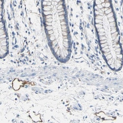 Podoplanin Antibody, Novus Biologicals:Antibodies:Primary Antibodies