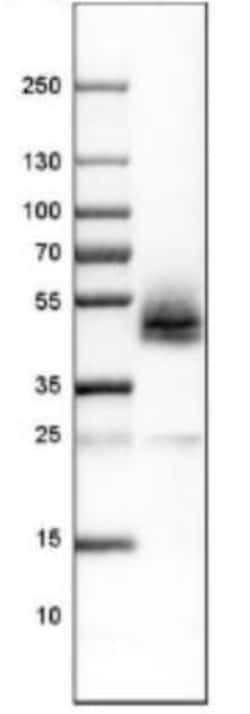 Podoplanin Antibody, Novus Biologicals:Antibodies:Primary Antibodies