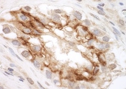 Polycystin 2 Antibody, Novus Biologicals 0.1mL; Unlabeled:Antibodies, Polyclonal