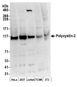 Polycystin 2 Antibody, Novus Biologicals 0.1mL; Unlabeled:Antibodies, Polyclonal