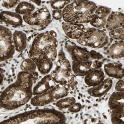 Polypeptide GalNac Transferase 1/GALNT1 Antibody, Novus Biologicals:Anticuerpos:Anticuerpos