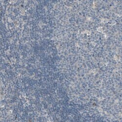 Polypeptide GalNac Transferase 3/GALNT3 Antibody, Novus Biologicals 0.1 mL | Buy Online | Novus Biologicals | Fisher Scientific