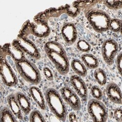 Polypeptide GalNac Transferase 3/GALNT3 Antibody, Novus Biologicals 0.1 mL | Buy Online | Novus Biologicals | Fisher Scientific