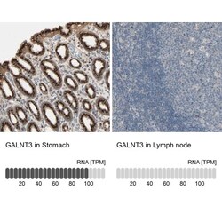 Polypeptide GalNac Transferase 3/GALNT3 Antibody, Novus Biologicals 0.1 mL | Buy Online | Novus Biologicals | Fisher Scientific
