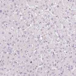 Polypeptide GalNac Transferase 7/GALNT7 Antibody, Novus Biologicals 0.1mL;