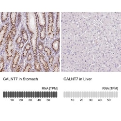 Polypeptide GalNac Transferase 7/GALNT7 Antibody, Novus Biologicals 0.1mL;