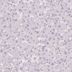 Polypeptide GalNac Transferase 7/GALNT7 Antibody, Novus Biologicals:Antibodies:Primary