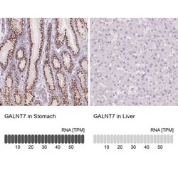 Polypeptide GalNac Transferase 7/GALNT7 Antibody, Novus Biologicals:Antibodies:Primary