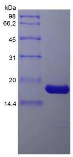 Novus Biologicals Recombinant Porcine IL-1 beta/IL-1F2 Protein 100 &mu;g | Buy Online | Novus Biologicals&trade; | Fisher Scientific