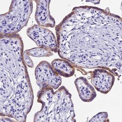 Pregnancy specific beta 1 glycoprotein 11 Antibody, Novus Biologicals 25