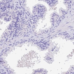 Pregnancy specific beta 1 glycoprotein 11 Antibody, Novus Biologicals 25