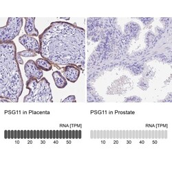 Pregnancy specific beta 1 glycoprotein 11 Antibody, Novus Biologicals 25