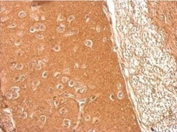 Presenilin-1 Antibody, Novus Biologicals 0.1mL; Unlabeled:Antibodies, Polyclonal