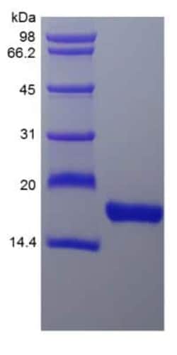 Novus Biologicals Recombinant Rhesus Macaque Flt-3 Ligand/FLT3L Protein 10 &mu;g | Buy Online | Novus Biologicals&trade; | Fisher Scientific