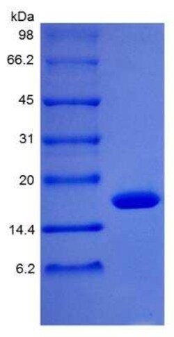 Novus Biologicals Recombinant Rhesus Macaque G-CSF Protein 500 &mu;g | Buy Online | Novus Biologicals&trade; | Fisher Scientific