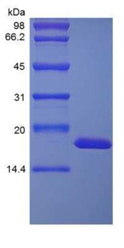 Novus Biologicals Recombinant Rhesus Macaque IL-1 alpha/IL-1F1 Protein 500 &mu;g | Buy Online | Novus Biologicals&trade; | Fisher Scientific