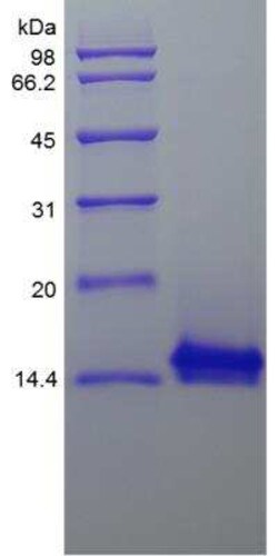 Novus Biologicals Recombinant Rhesus Macaque IL-4 Protein 1 mg | Buy Online | Novus Biologicals&trade; | Fisher Scientific