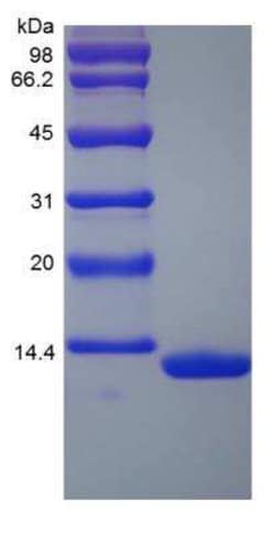 Novus Biologicals&trade;&nbsp;Recombinant Rhesus Macaque Serum Amyloid A1 Protein