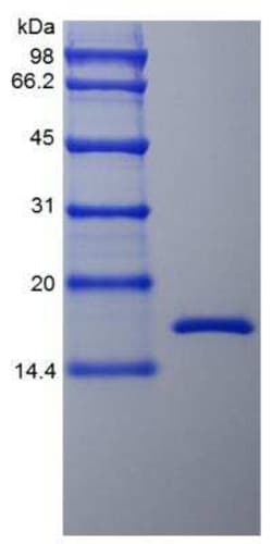 Novus Biologicals Recombinant Rhesus Macaque TNF-alpha Protein 1 mg | Buy Online | Novus Biologicals&trade; | Fisher Scientific