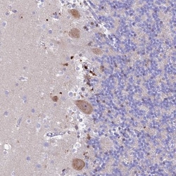 PrPC Antibody, Novus Biologicals:Antibodies:Primary Antibodies
