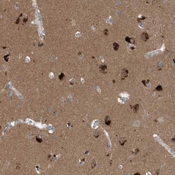Profilin 2 Antibody, Novus Biologicals 25 &mu;L; Unlabeled:Antibodies,