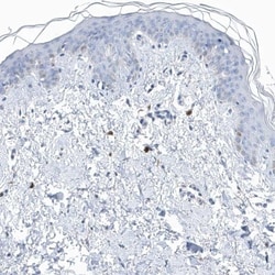 Profilin 2 Antibody, Novus Biologicals 25 &mu;L; Unlabeled:Antibodies,