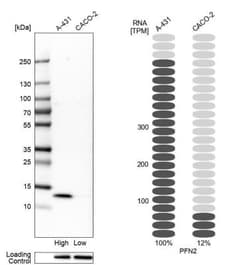 Profilin 2 Antibody, Novus Biologicals 25 &mu;L; Unlabeled:Antibodies,